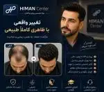 پروتز مو طبیعی در اصفهان