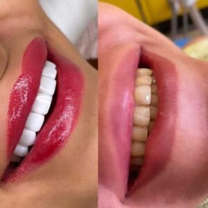 دندانپزشکی لبخند زیبا