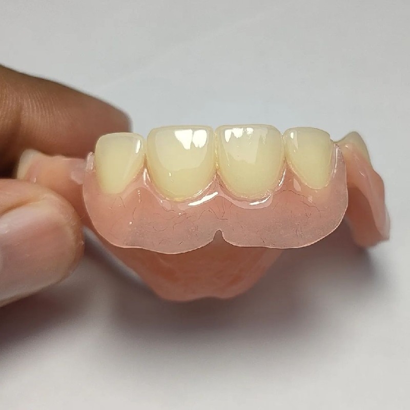 ساخت دندان مصنوعی با ضمانت