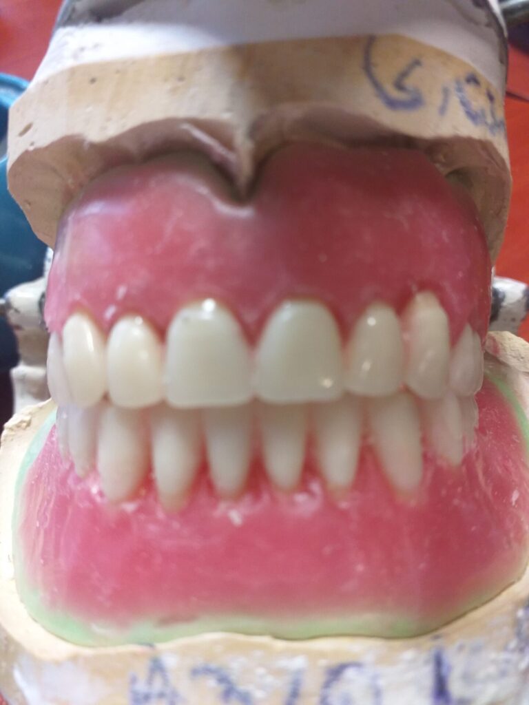 لابراتوار دندانسازی, دندان مصنوعی سعادت آباد